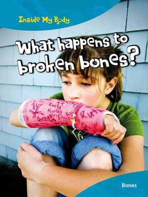 cover image of What Happens to Broken Bones?